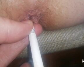 Cigarette in the anus!